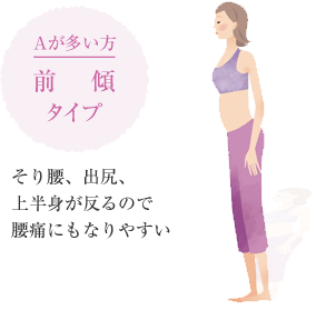 Aが多い方 前傾タイプ そり腰、出尻、上半身が反るので腰痛にもなりやすい