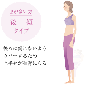 Bが多い方 後傾タイプ 後ろに倒れないようカバーするため上半身が貓背になる