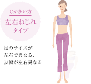 Cが多い方 左右ねじれタイプ 足のサイズが左右で異なる、歩幅が左右異なる